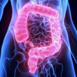 Colon Cancer Warning