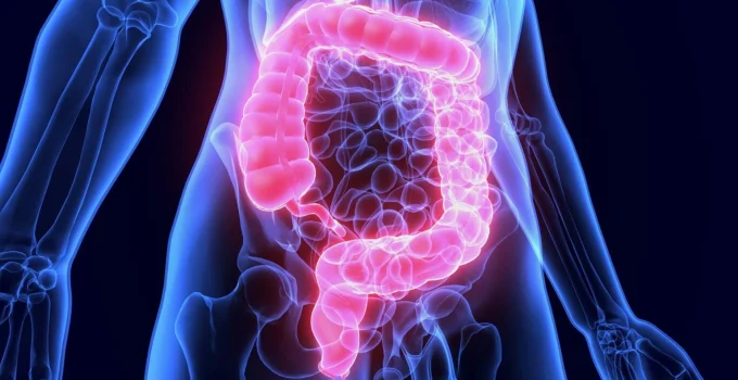 Colon Cancer Warning